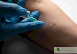 Тетанус: Симптоми, ранни признаци, лечение и превенция