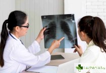 Пневмоторакс