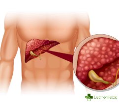 Чернодробен хемангиом