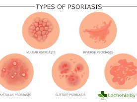 Гъбички по кожата и техните видове