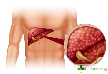 Чернодробен хемангиом