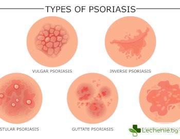 Гъбички по кожата и техните видове