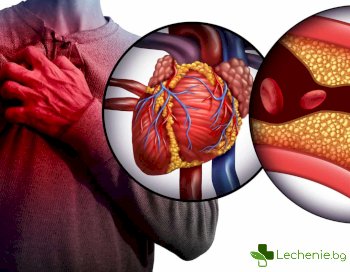 Миокарден инфаркт и как да го разпознаем