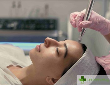 Същност на микродермабразиото