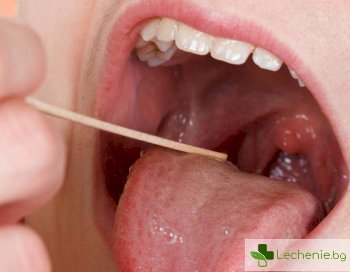 Кървене на езика