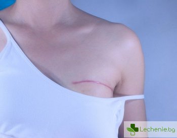 Белези на кожата от травми - възможно ли е да се скрият с татуировки