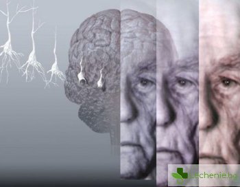 Топ 5 ранни симптоми на съдова деменция