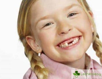 Какви са причините за деформации на зъбните редици на децата и тийнейджърите