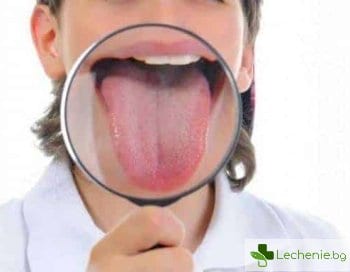 Как се лекува възпаление на езика