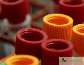 Топ 5 важни факта за фосфора в кръвта и урината