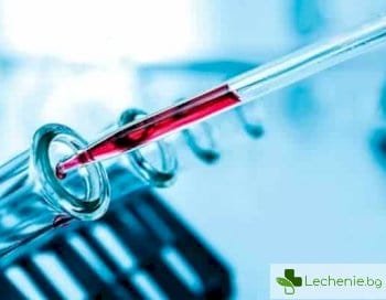 Какво може да повлияе на резултатите от общите медицински изследвания