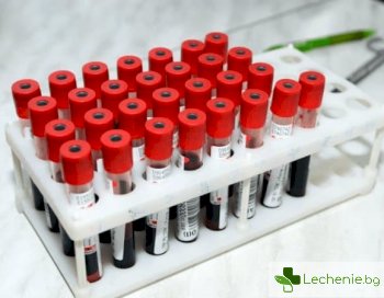 Изследване на газовия състав на артериалната кръв