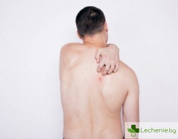 Мастоцитоза - увреждане на кожата, системни реакции