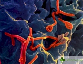 Предпазват ли лукът и прясното мляко от ебола?