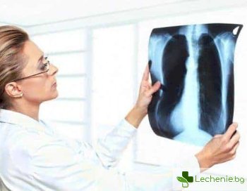 Кардиогенен оток на белите дробове - защо се развива и как протича