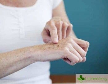 Защо се появява пигментация на кожата и как да се избавим