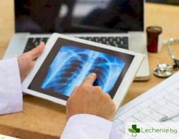 Топ 5 неочаквани причини за лятна пневмония
