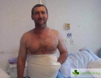 Хирурзи зашиха ръката на бразилец в корема, за да я спасят от ампутация