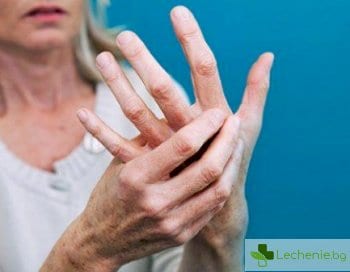 Топ 5 заблуди за ревматоидния артрит - №3 болестта слага край на работа и кариера
