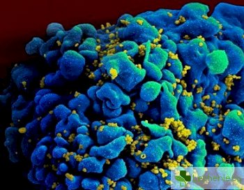 Вирусът на СПИН-а подпомага лечението на злокачествени заболявания?