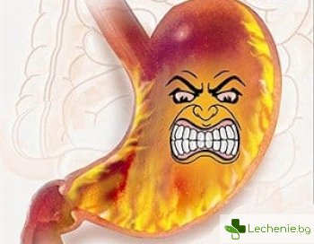 Киселини на нервна почва - пагубното въздействие на стреса върху стомаха