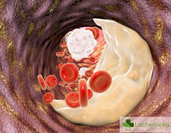 Лимфната система може да се пребори с плаката в кръвоносните съдове