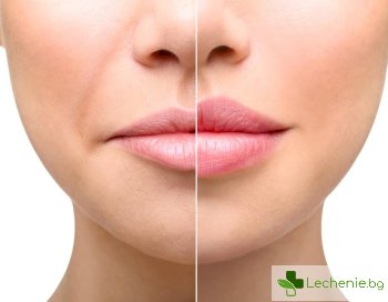 Подуване на устните – 8 причини и как можем да го спрем