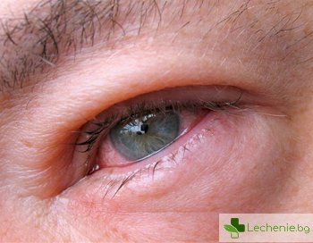 Kръвоизливи в очите - опасни ли са за здравето