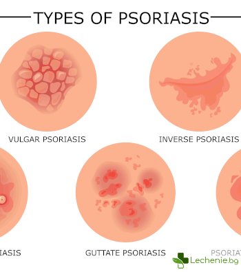 Гъбички по кожата и техните видове