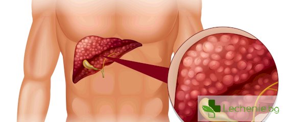 Чернодробен хемангиом