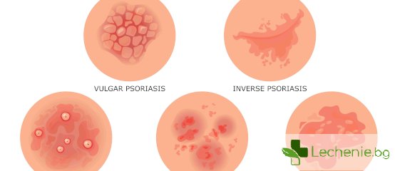 Гъбички по кожата и техните видове