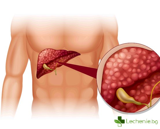 Чернодробен хемангиом