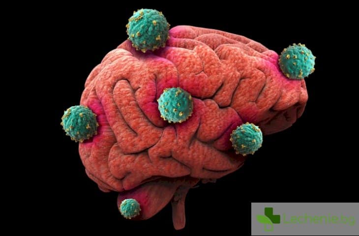 Антихистамините потенциално лекарство при рак на мозъка