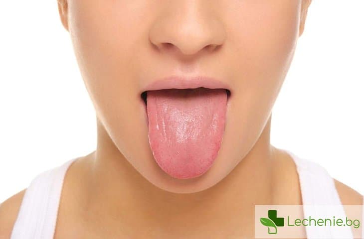 Прорези по езика – откъде се появяват и трябва ли лечение
