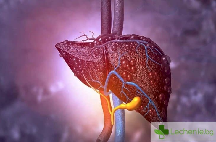 Черен дроб - как да подобрим здравословното му състояние