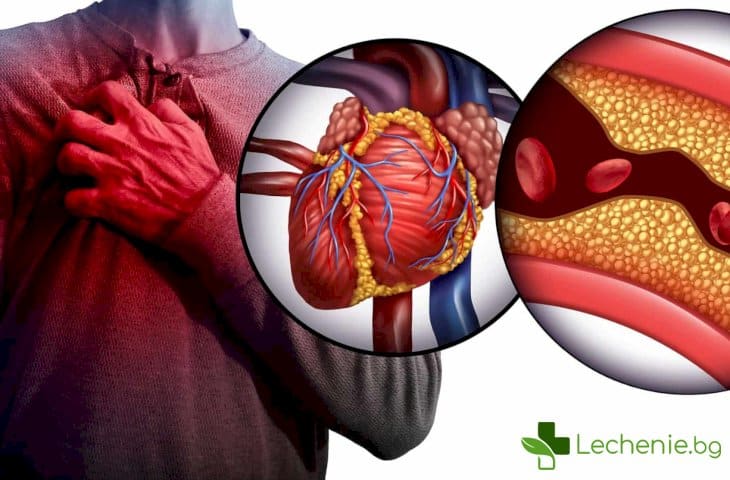 Миокарден инфаркт и как да го разпознаем