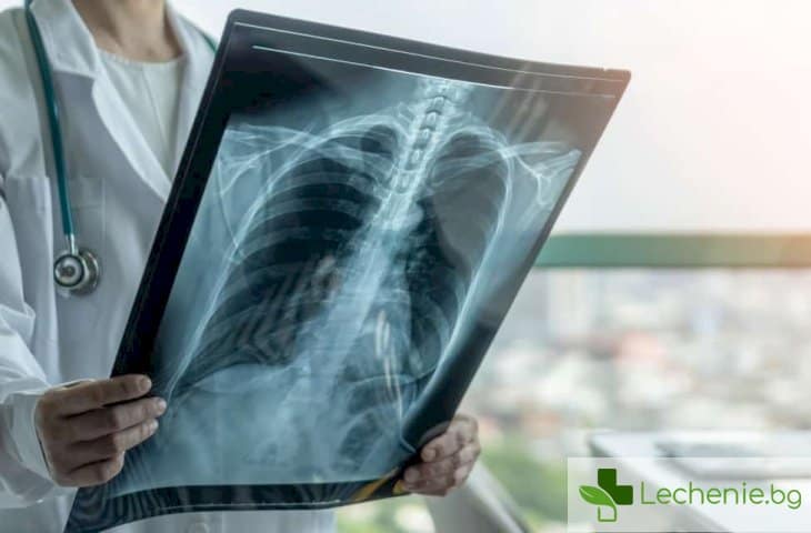 Рентгенови снимки - вредни ли са