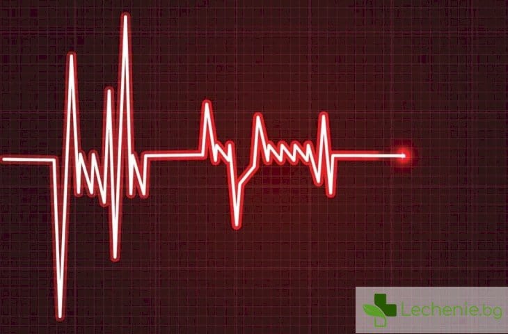 Сърдечна аритмия - какво представлява