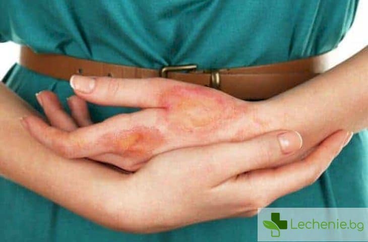 Анетодермия - какво се случва с кожата