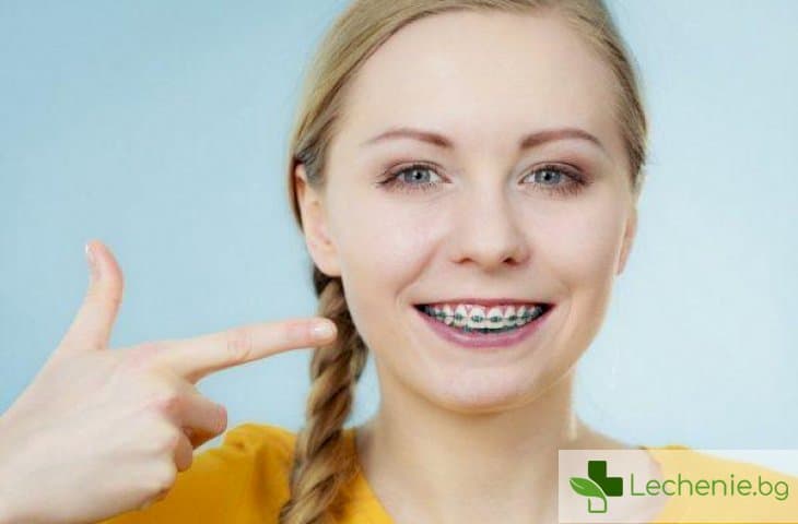 Зъбобол след поставяне на брекети - норма или патология