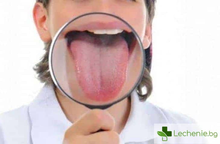 Как се лекува възпаление на езика