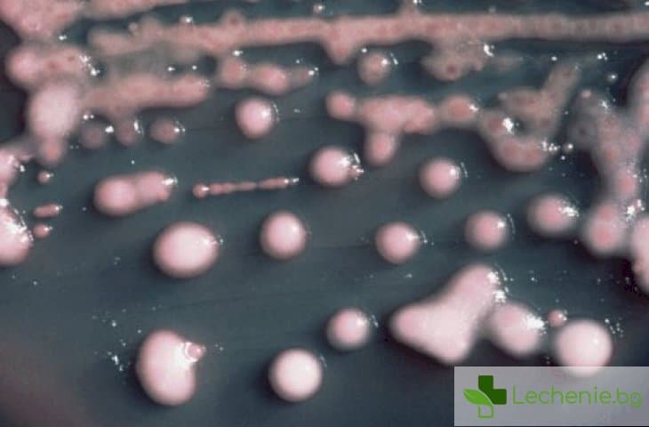 Клебсиела в урината - норма, повишени нива и лечение