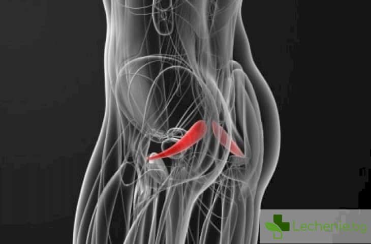 Синдром на крушовидния мускул - какво представлява и как да се избавим от него
