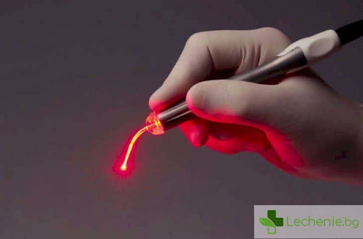 Лечение на синузит с лазер - ето колко е ефективно