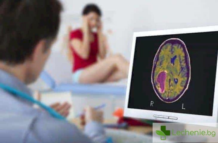 Топ 5 най-големи заблуди за туморите на мозъка