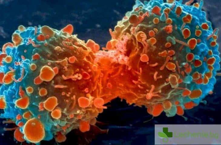 Раковите клетки на млечната жлеза дълги години се укриват в костите