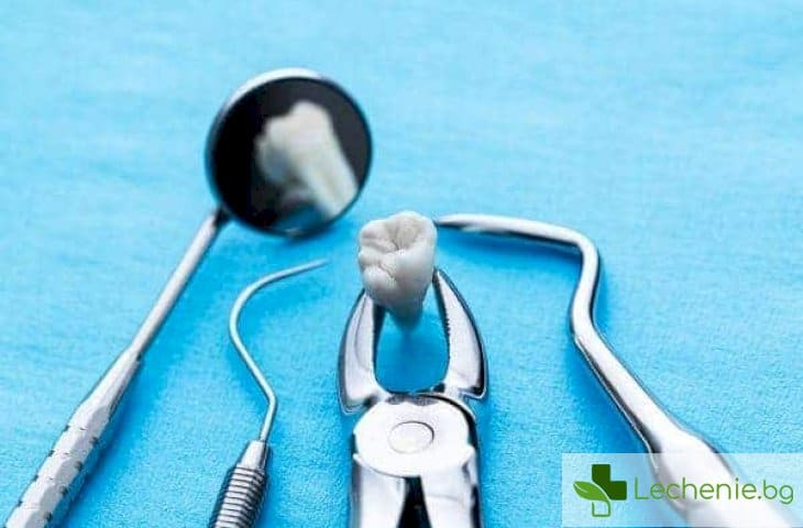 Невралгия, киста и други причини за погрешно вадене на здрави зъби