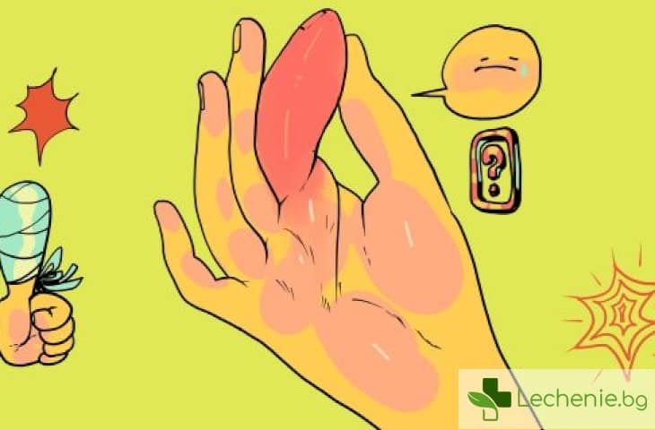 Подуване на пръстите – причини и как можем да го спрем